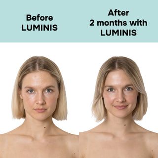 LUMINIS – Masque LED Premium pour Éclat & Rides