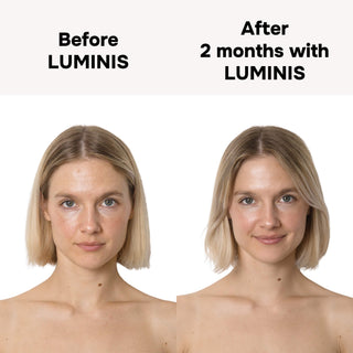 LUMINIS – Masque LED Premium pour Éclat & Rides